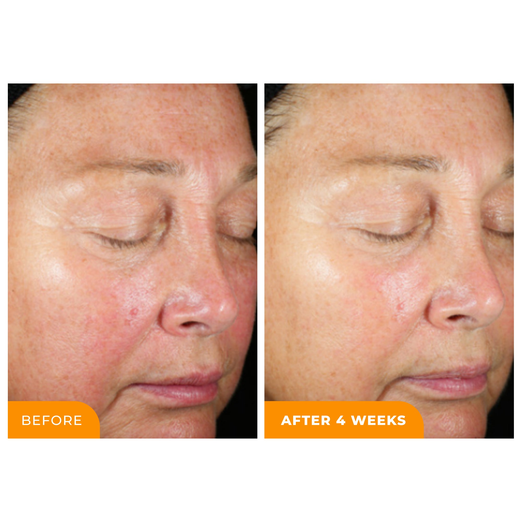 BeautyStat Healthy Skin 4-Step Essentials with SPF