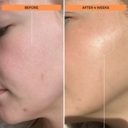 Universal C Skin Refiner 50ml